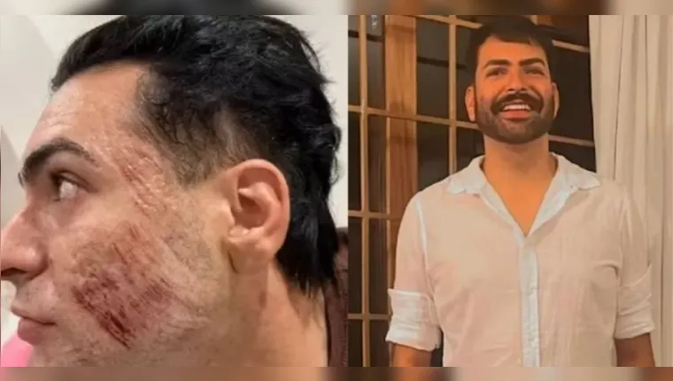 Empresário morreu após inalar fenol em peeling, aponta laudo