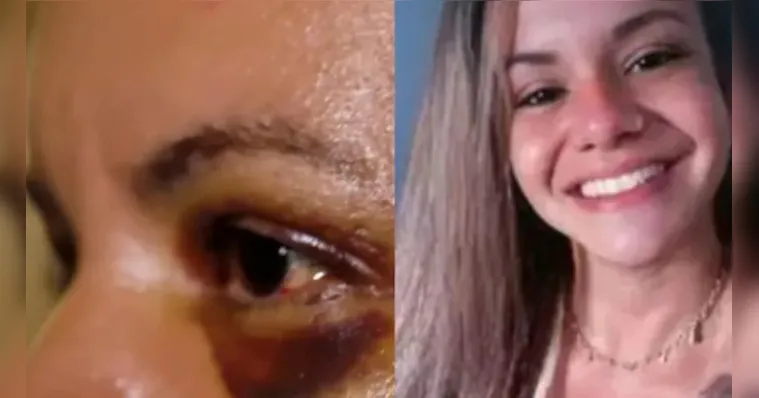 Mulher que levou 61 socos diz por que não se separou de agressor