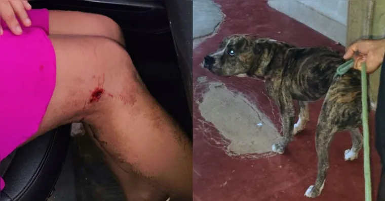 Pitbull ataca mulher e os três filhos dentro de casa no Pará