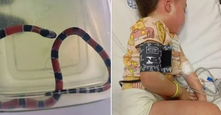 Criança ficou estado grave devido a picada da cobra | Reprodução/Redes Sociais